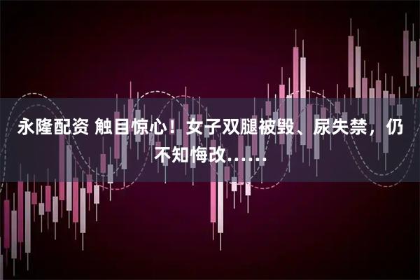 永隆配资 触目惊心！女子双腿被毁、尿失禁，仍不知悔改……